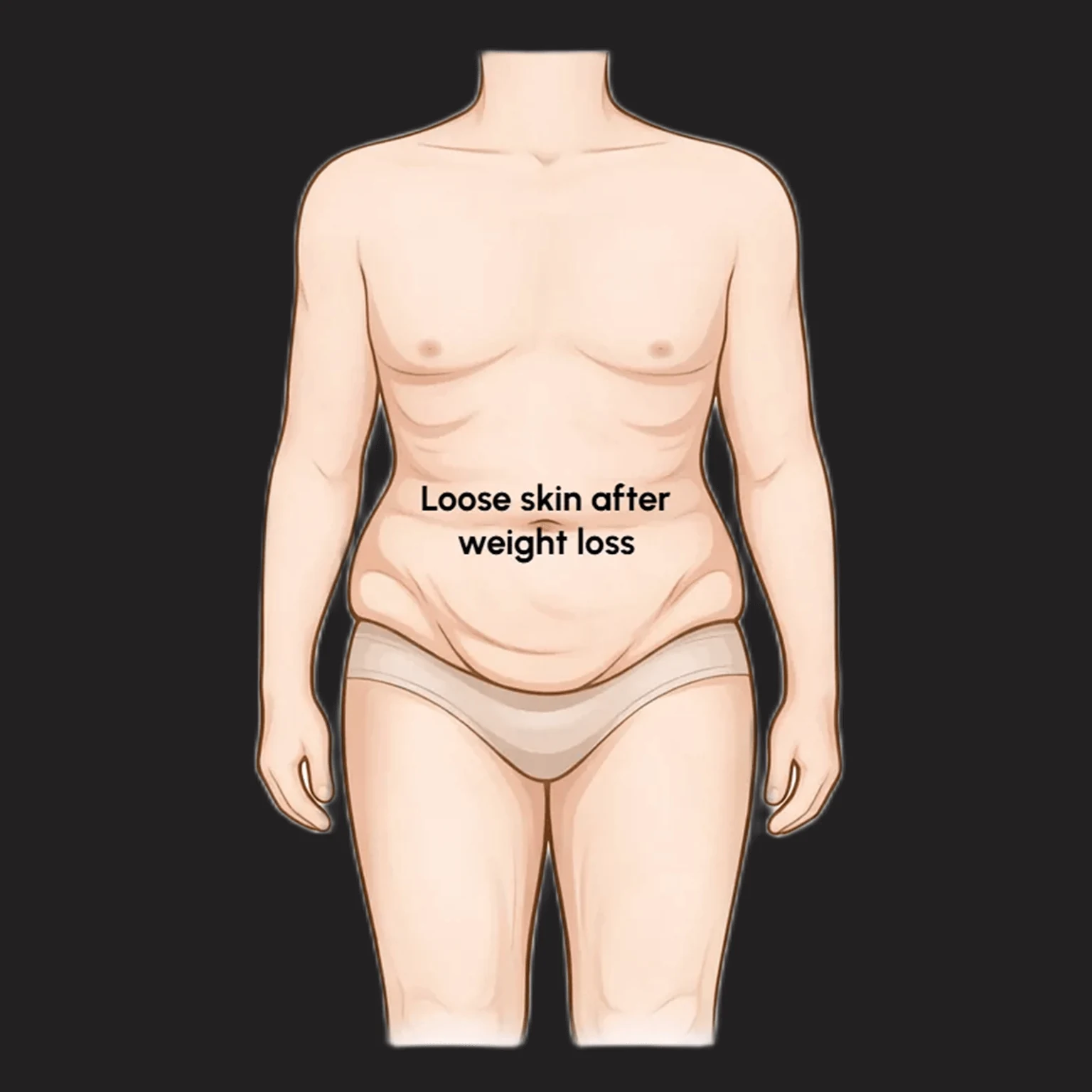 Loose Skin After Weight Loss: Causes, Treatment Options, and When Surgery May Be Considered